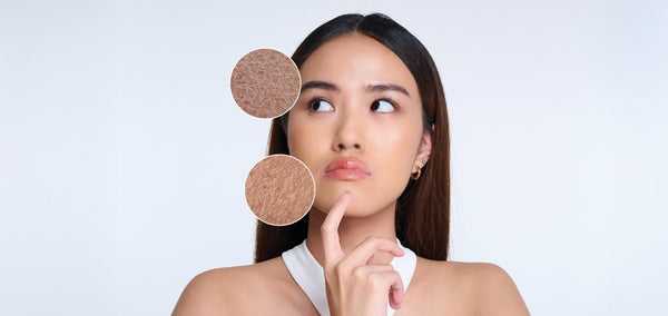 Banyak yang Salah! Begini Cara Merawat Kulit Kering Agar Tetap Lembap & Sehat