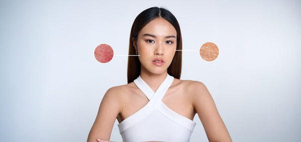 Tes Kulit Sensitif: Apakah Kulitmu Termasuk? Cari Tahu di Sini!